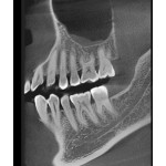     Rayscan α+ 3D 160x100 Ceph